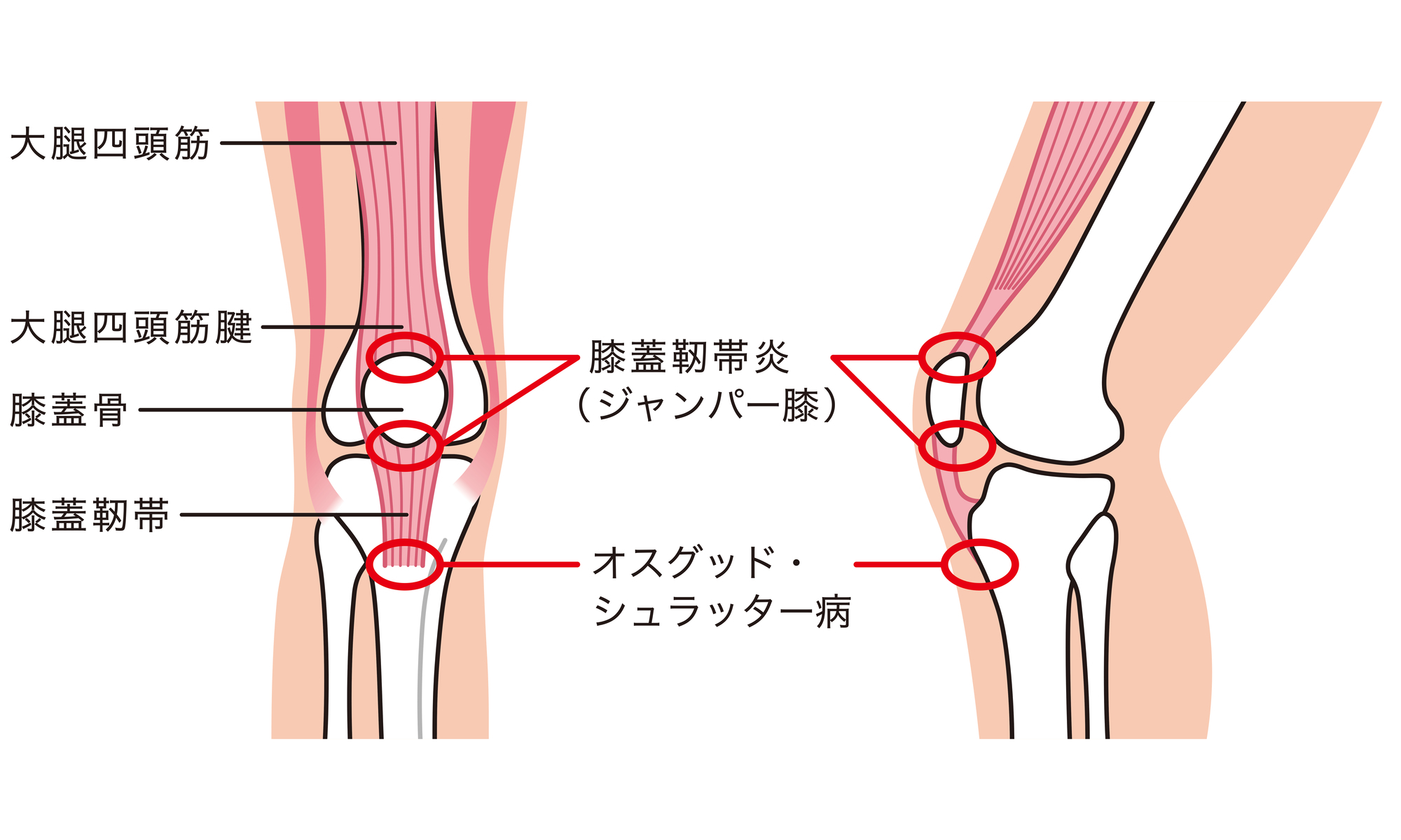 イラスト：ジャンパー膝