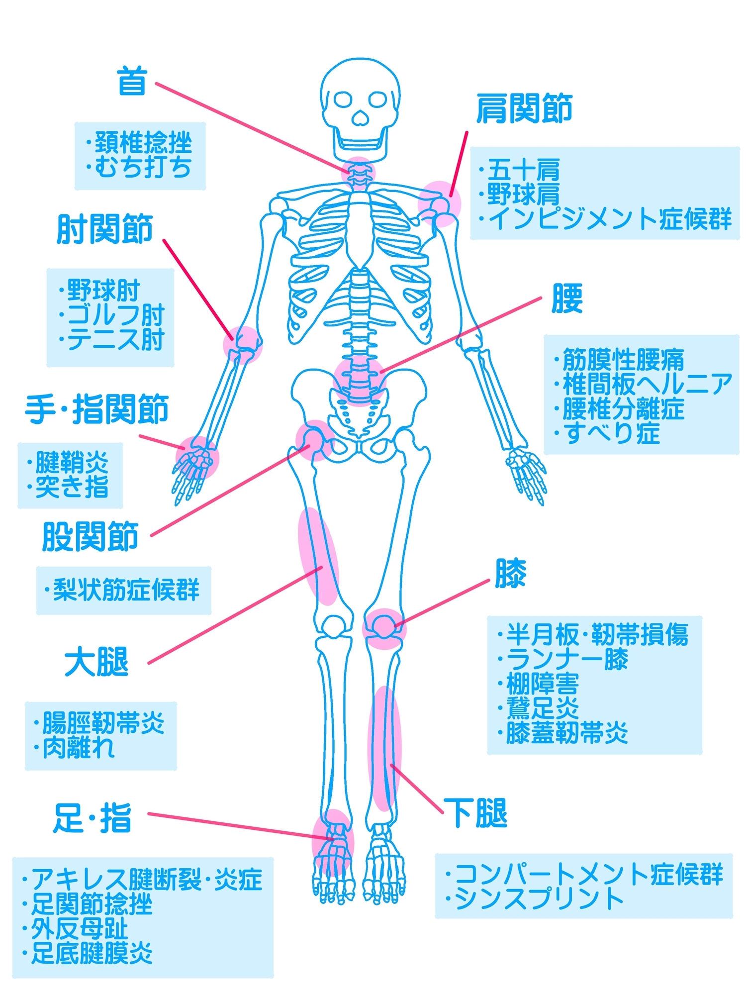 イラスト：スポーツ外傷の種類